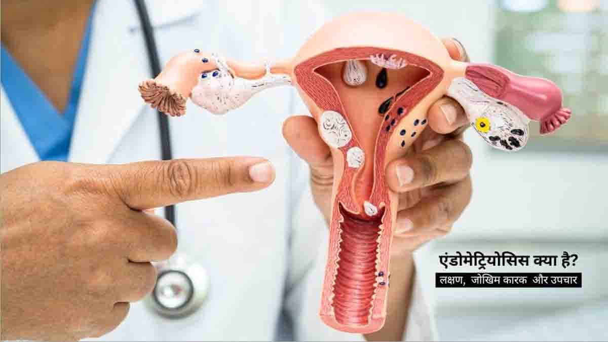 Causes of Infertility: एंडोमेट्रिओसिस की बीमारी बन सकती निःसंतानता का कारण, इस तरह से कर सकते हैं समाधान: डॉ चंचल शर्मा